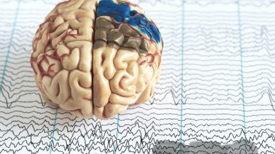Epidiolex®: A Breakthrough CBD Anti-Epileptic Medication - Coastal Hemp Co